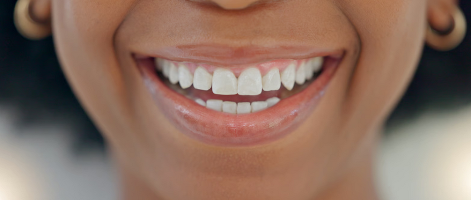 Dental work in Ghana explained for expats and diaspora. Costs, top clinics, insurance, regulation, safety checks, and practical planning for 2026.